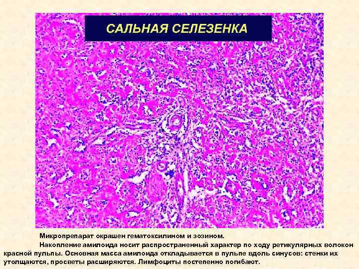 Саговая селезенка микропрепарат рисунок