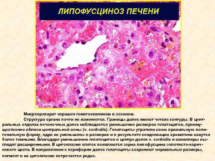 Микропрепарат окрашен гематоксилином и эозином. Структура органа почти не изменяется. Границы долек имеют четкие