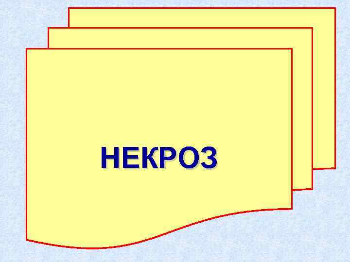 НЕКРОЗ 