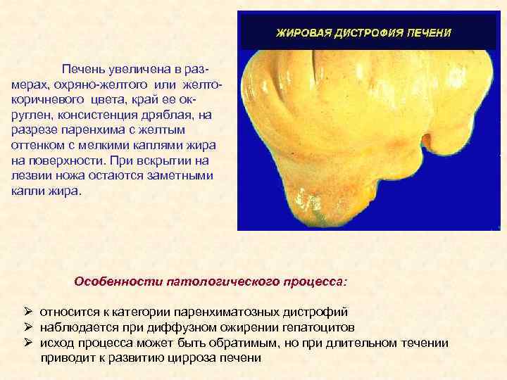 Печень увеличена в размерах, охряно-желтого или желтокоричневого цвета, край ее округлен, консистенция дряблая, на