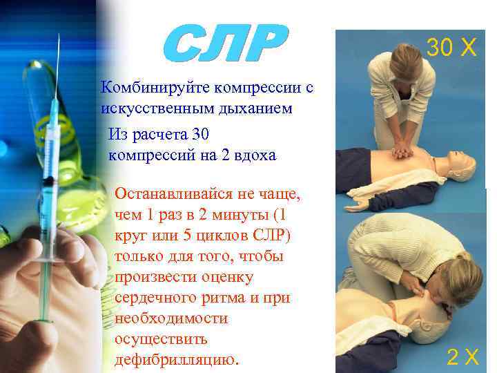 30 X Комбинируйте компрессии с искусственным дыханием Из расчета 30 компрессий на 2 вдоха