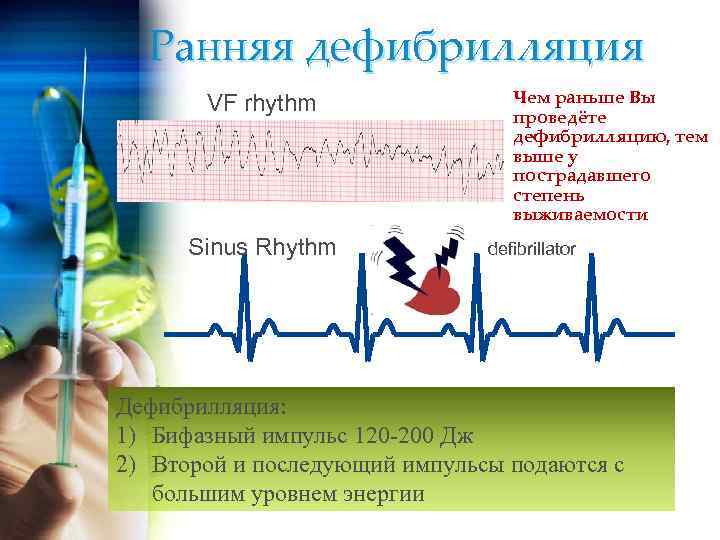 Ранняя дефибрилляция VF rhythm Sinus Rhythm Чем раньше Вы проведёте дефибрилляцию, тем выше у