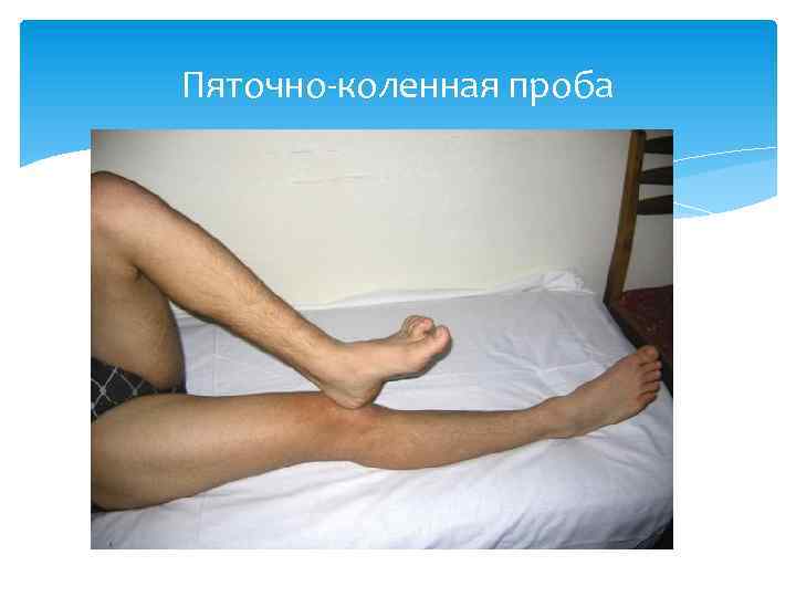 Пяточно-коленная проба 