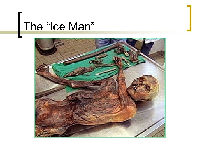 The “Ice Man” 