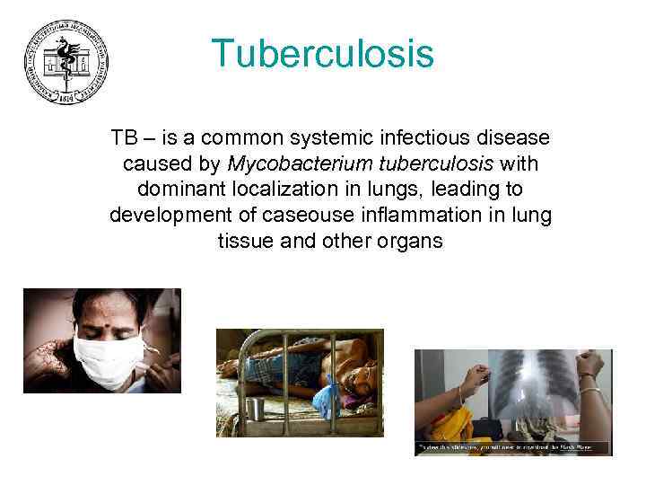 Tuberculosis TB – is a common systemic infectious disease caused by Mycobacterium tuberculosis with