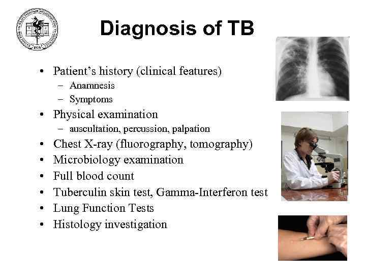 Diagnosis of TB • Patient’s history (clinical features) – Anamnesis – Symptoms • Physical