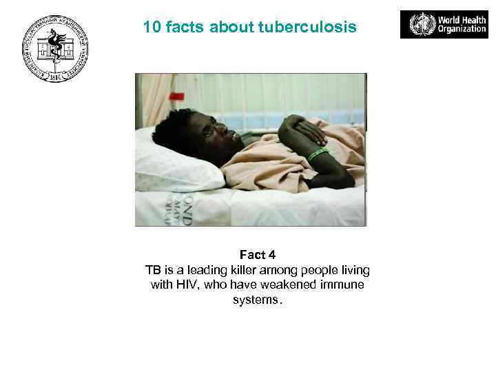 10 facts about tuberculosis Fact 4 TB is a leading killer among people living