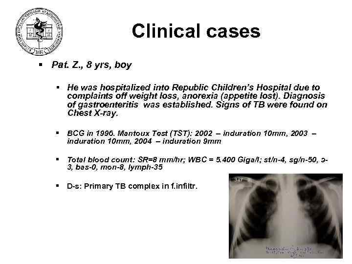 Clinical cases § Pat. Z. , 8 yrs, boy § He was hospitalized into