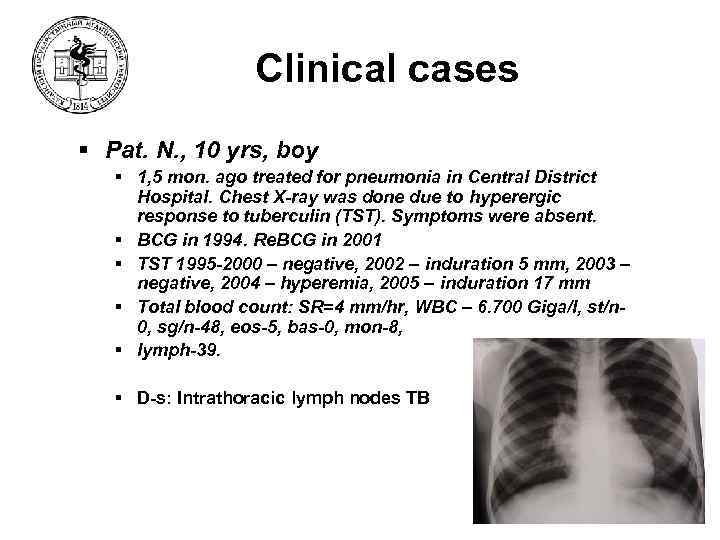 Clinical cases § Pat. N. , 10 yrs, boy § 1, 5 mon. ago