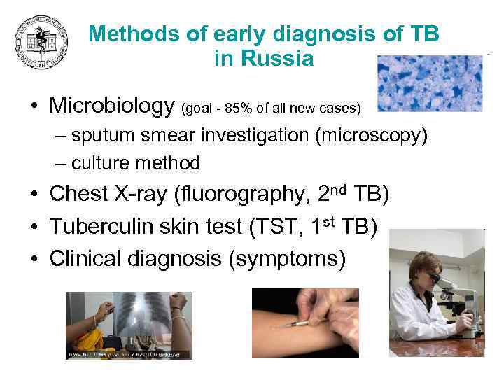 Methods of early diagnosis of TB in Russia • Microbiology (goal - 85% of