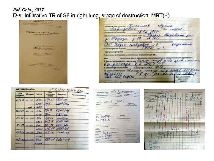 Pat. Chis. , 1977 D-s: Infiltrative TB of S 6 in right lung, stage