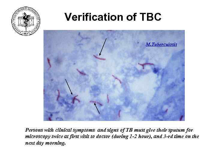 Verification of ТВС M. Tuberculosis Persons with clinical symptoms and signs of TB must