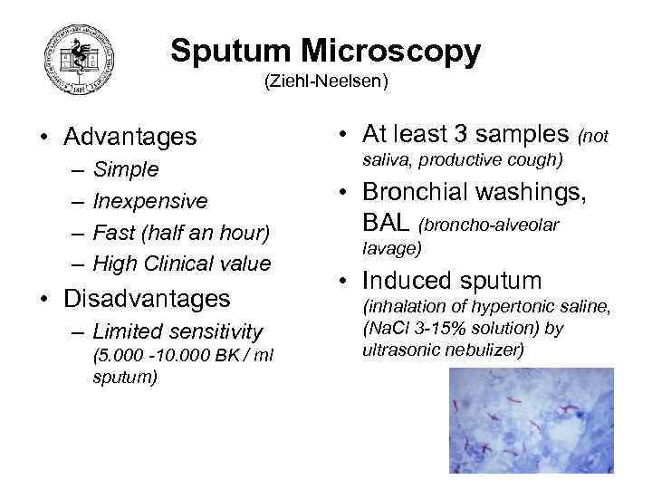 Sputum Microscopy (Ziehl-Neelsen) • Advantages – – Simple Inexpensive Fast (half an hour) High