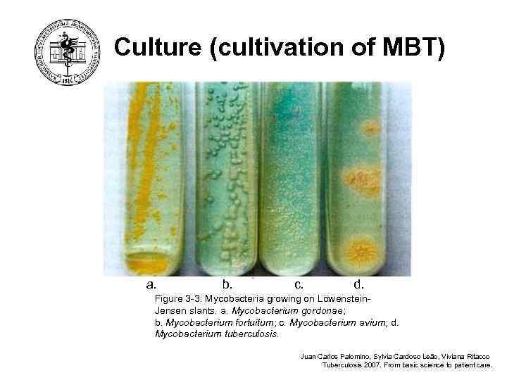 Culture (cultivation of MBT) a. b. c. d. Figure 3 -3: Mycobacteria growing on