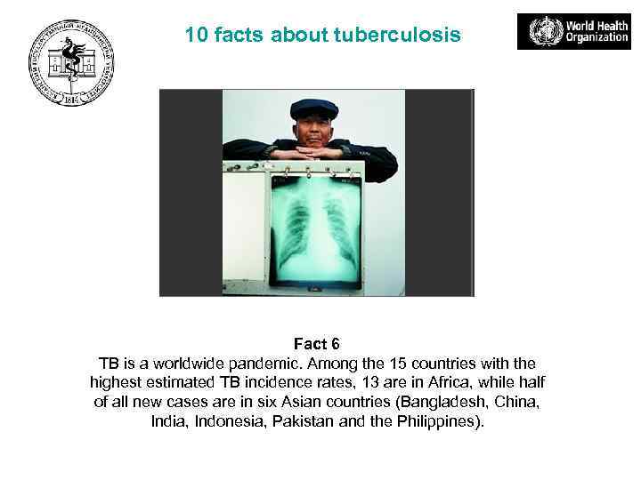 10 facts about tuberculosis Fact 6 TB is a worldwide pandemic. Among the 15