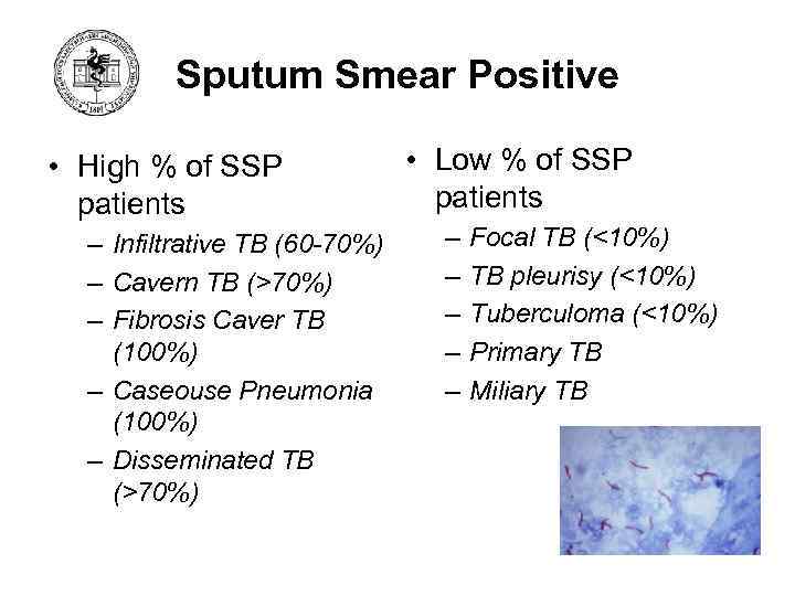 Sputum Smear Positive • High % of SSP patients – Infiltrative TB (60 -70%)