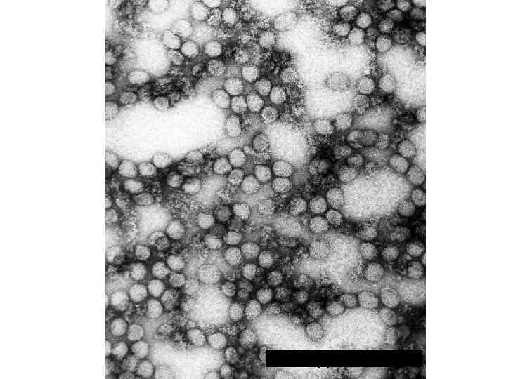Вирус гепатита С 