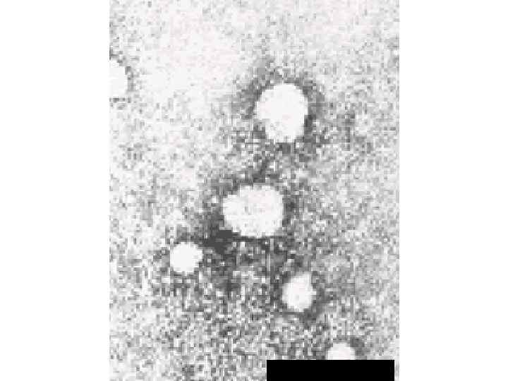 Вирус гепатита D 