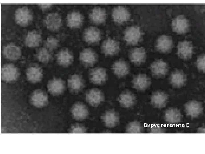 Вирус гепатита Е 