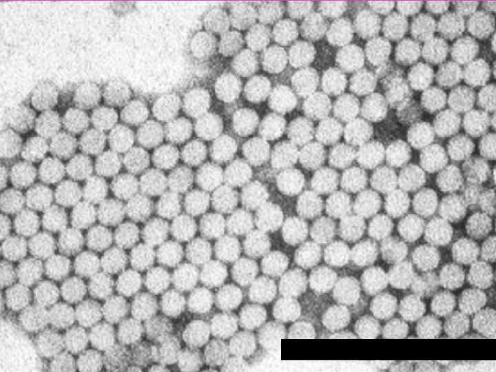 Вирус гепатита А 