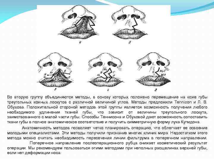 Во вторую группу объединяются методы, в основу которых положено перемещение на коже губы треугольных