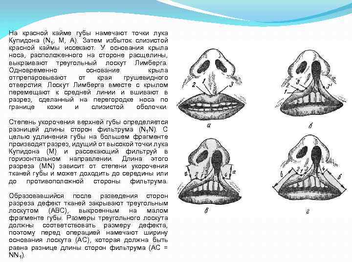На красной кайме губы намечают точки лука Купидона (N 1, М, А). Затем избыток