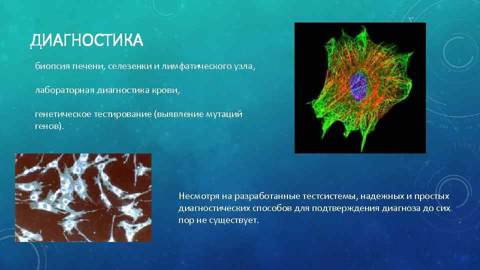 ДИАГНОСТИКА биопсия печени, селезенки и лимфатического узла, лабораторная диагностика крови, генетическое тестирование (выявление мутаций