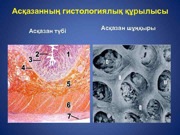 Ас қорыту жүйесінің патологиясы презентация