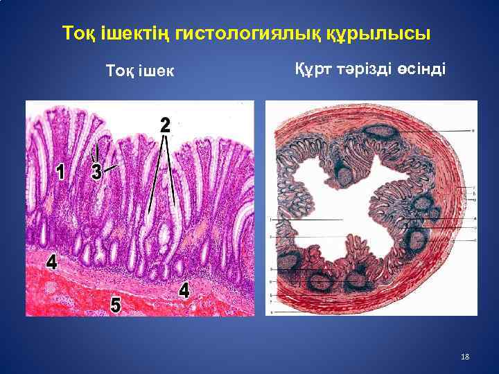 Тоқ ішек презентация