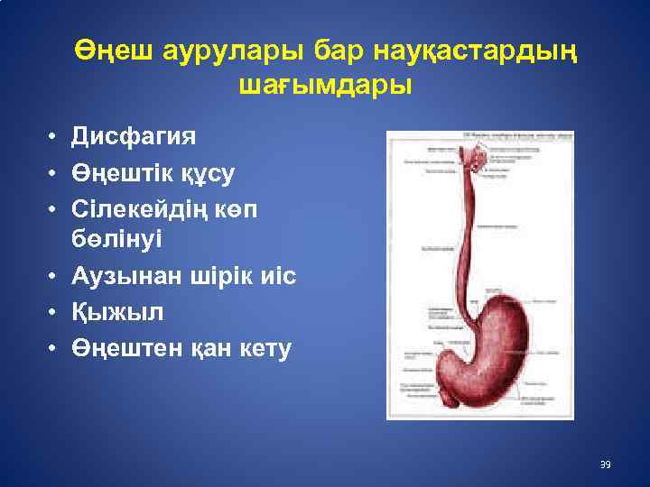 Өңеш аурулары бар науқастардың шағымдары • Дисфагия • Өңештік құсу • Сілекейдің көп бөлінуі