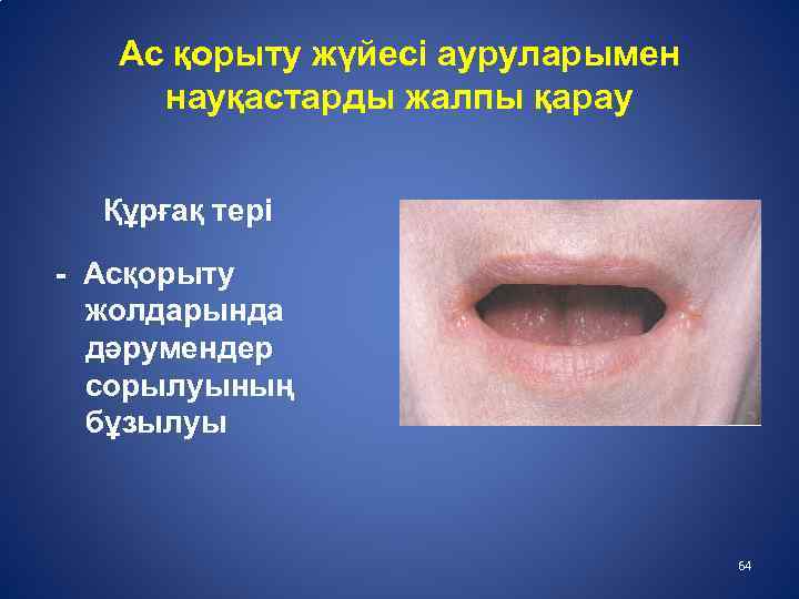 Ас қорыту жүйесі ауруларымен науқастарды жалпы қарау Құрғақ тері - Асқорыту жолдарында дәрумендер сорылуының