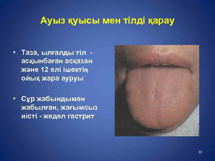 Ауыз қуысы мен тілді қарау • Таза, ылғалды тіл асқынбаған асқазан және 12 елі