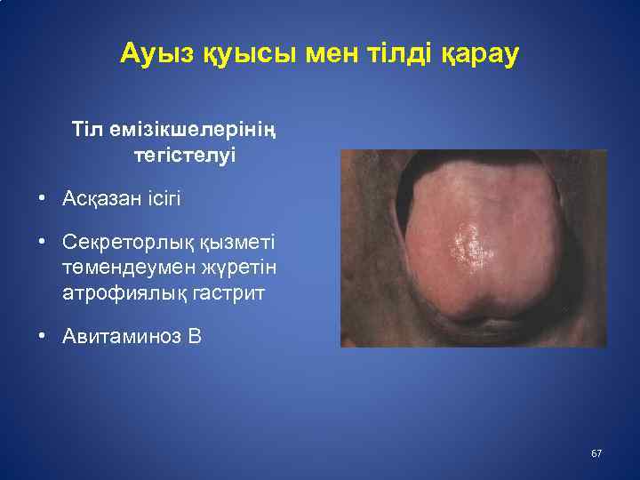 Ауыз қуысы мен тілді қарау Тіл емізікшелерінің тегістелуі • Асқазан ісігі • Секреторлық қызметі