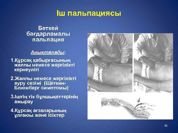 Іш пальпациясы Беткей бағдарламалы пальпация Анықталады: 1. Құрсақ қабырғасының жалпы немесе жергілікті кернеулігі 2.