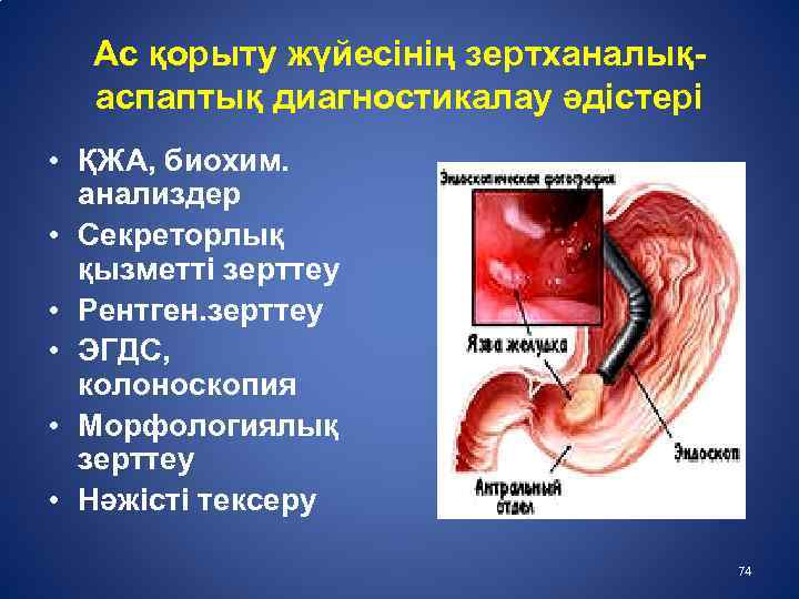 Ас қорыту жүйесінің патологиясы презентация