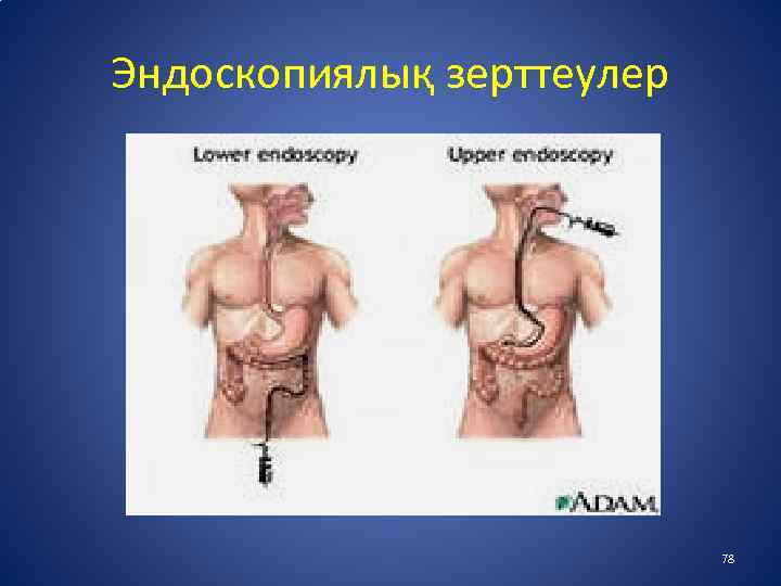 Эндоскопиялық зерттеулер 78 