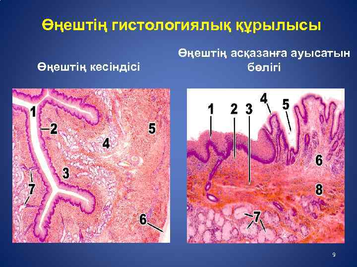 Өңештің гистологиялық құрылысы Өңештің кесіндісі Өңештің асқазанға ауысатын бөлігі 9 