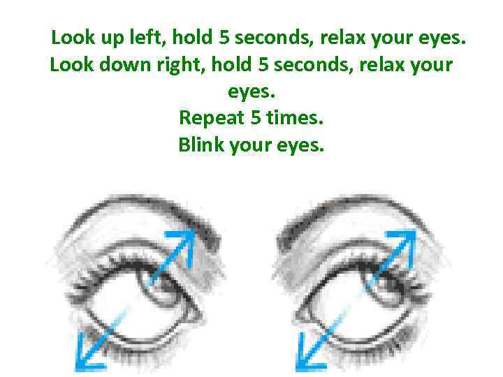 Look up left, hold 5 seconds, relax your eyes. Look down right, hold 5
