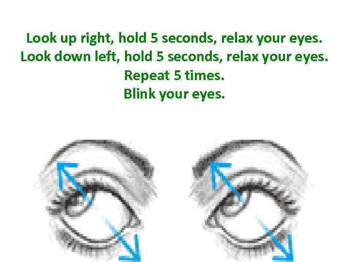 Look up right, hold 5 seconds, relax your eyes. Look down left, hold 5