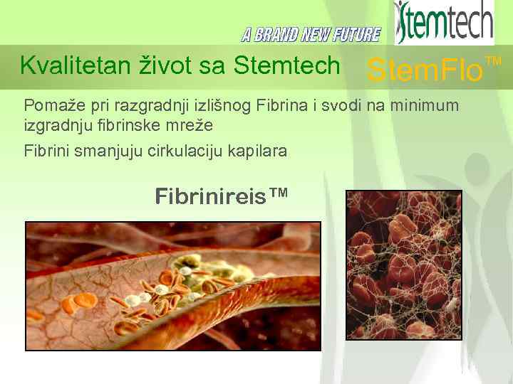 Kvalitetan život sa Stemtech ™ Stem. Flo Pomaže pri razgradnji izlišnog Fibrina i svodi