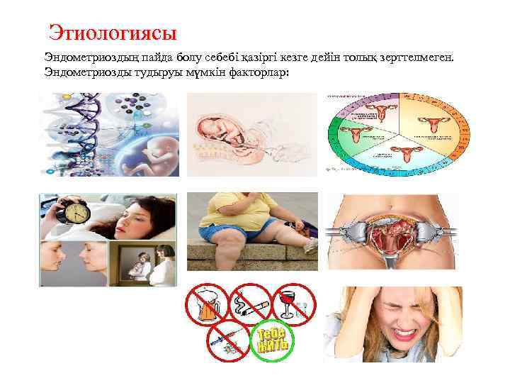 Этиологиясы Эндометриоздың пайда болу себебі қазіргі кезге дейін толық зерттелмеген. Эндометриозды тудыруы мүмкін факторлар: