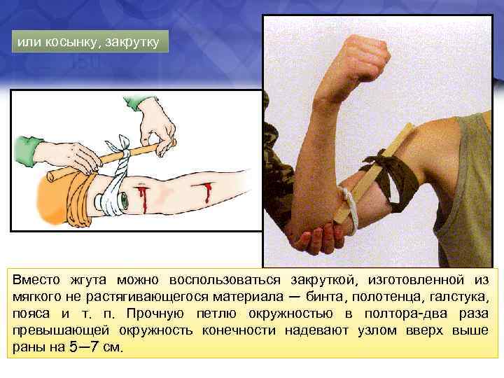 или косынку, закрутку Вместо жгута можно воспользоваться закруткой, изготовленной из мягкого не растягивающегося материала