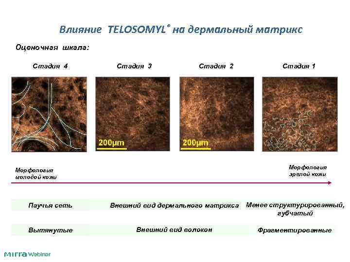 Влияние TELOSOMYL® на дермальный матрикс Оценочная шкала: Стадия 4 Стадия 3 Стадия 2 Морфология