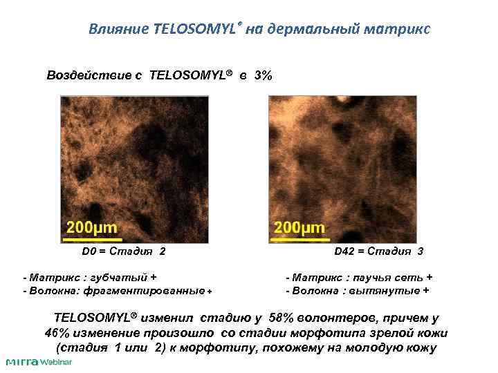  Влияние TELOSOMYL® на дермальный матрикс Воздействие с TELOSOMYL® в 3% D 0 =
