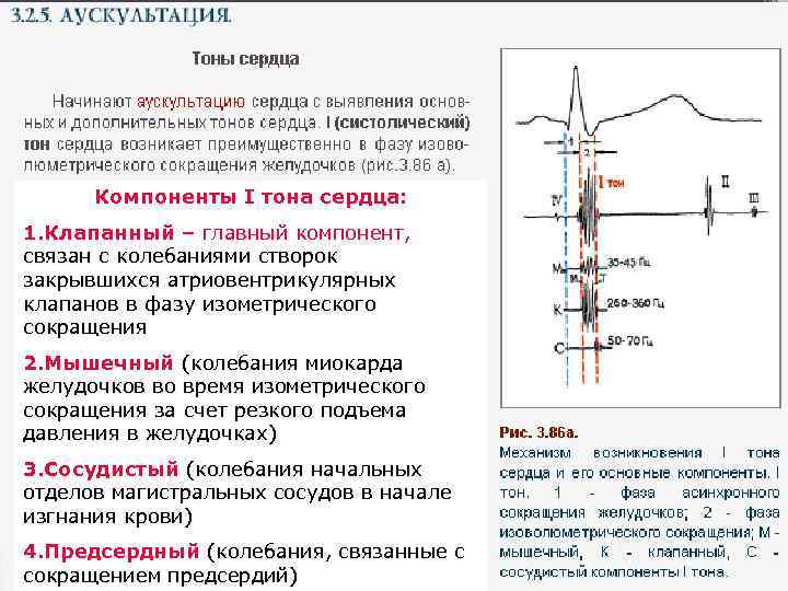 Компоненты I тона сердца: 1. Клапанный – главный компонент, связан с колебаниями створок закрывшихся