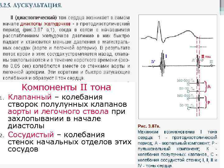 1. 2. Компоненты II тона Клапанный – колебания створок полулунных клапанов аорты и легочного