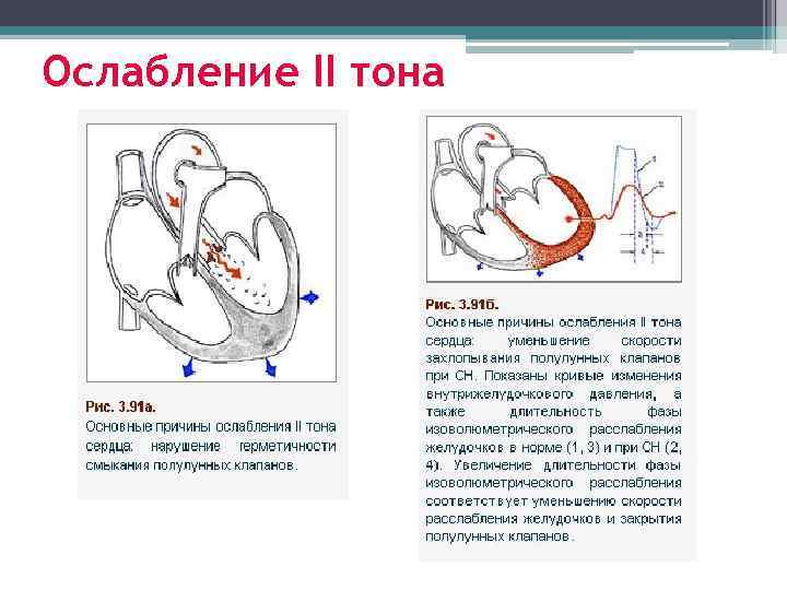 Схема тоны сердца