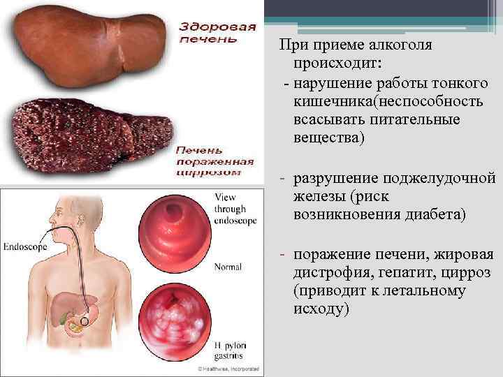 При приеме алкоголя происходит: - нарушение работы тонкого кишечника(неспособность всасывать питательные вещества) - разрушение