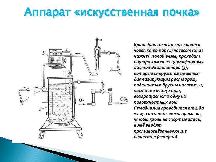 Принцип работы аппарата искусственная почка рисунок