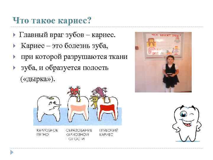 Что такое кариес? Главный враг зубов – кариес. Кариес – это болезнь зуба, при